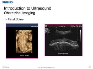 basic anatomy ob & gyn | PPTX
