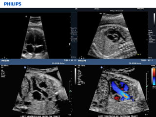 basic anatomy ob & gyn | PPTX