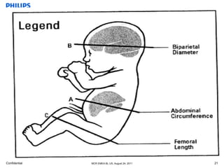 basic anatomy ob & gyn | PPTX