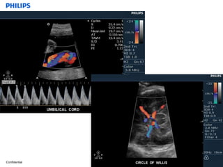 basic anatomy ob & gyn | PPTX