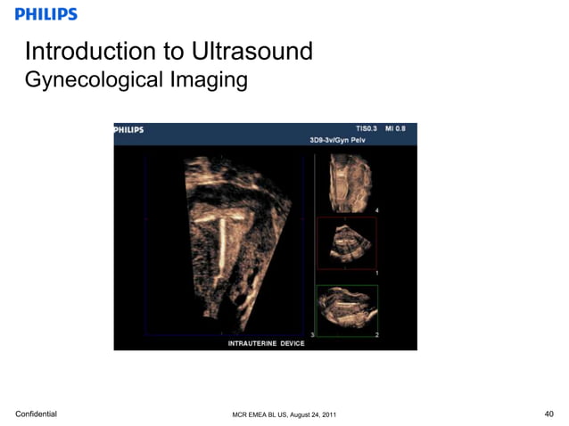 basic anatomy ob & gyn | PPTX