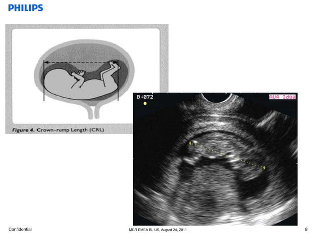 basic anatomy ob & gyn | PPTX