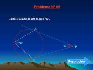 Calcule la medida del ángulo “X”. Problema Nº 06 70° B A X P Resolución 