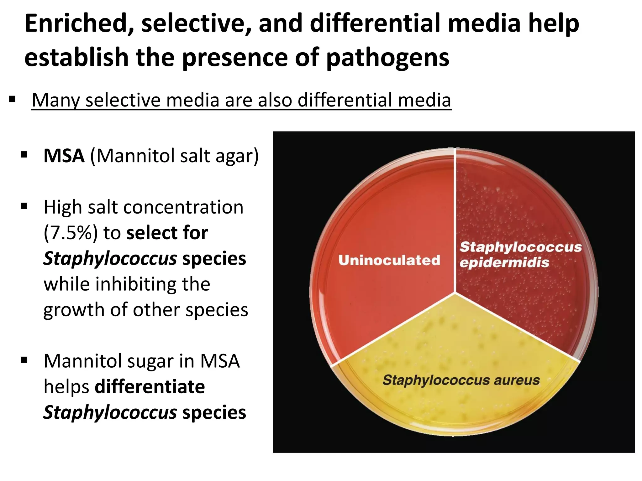 Enriched, selective, and differential media help
establish the presence of pathogens
 Many selective media are also differential media
 MSA (Mannitol salt agar)
 High salt concentration
(7.5%) to select for
Staphylococcus species
while inhibiting the
growth of other species
 Mannitol sugar in MSA
helps differentiate
Staphylococcus species
 
