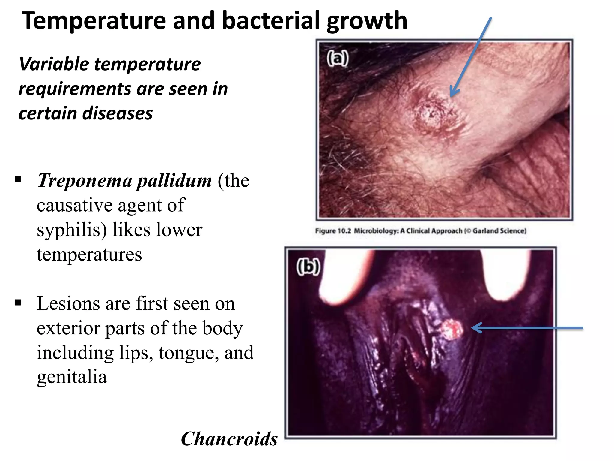  Treponema pallidum (the
causative agent of
syphilis) likes lower
temperatures
 Lesions are first seen on
exterior parts of the body
including lips, tongue, and
genitalia
Variable temperature
requirements are seen in
certain diseases
Chancroids
Temperature and bacterial growth
 