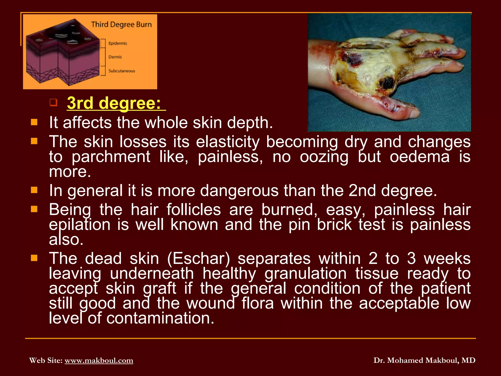 3rd degree:  It affects the whole skin depth.  The skin losses its elasticity becoming dry and changes to parchment like, painless, no oozing but oedema is more.  In general it is more dangerous than the 2nd degree.  Being the hair follicles are burned, easy, painless hair epilation is well known and the pin brick test is painless also.  The dead skin (Eschar) separates within 2 to 3 weeks leaving underneath healthy granulation tissue ready to accept skin graft if the general condition of the patient still good and the wound flora within the acceptable low level of contamination. 