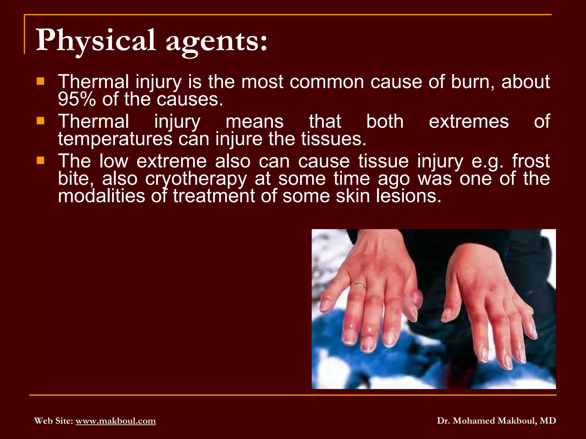 Physical agents: Thermal injury is the most common cause of burn, about 95% of the causes.  Thermal injury means that both extremes of temperatures can injure the tissues.  The low extreme also can cause tissue injury e.g. frost bite, also cryotherapy at some time ago was one of the modalities of treatment of some skin lesions. 