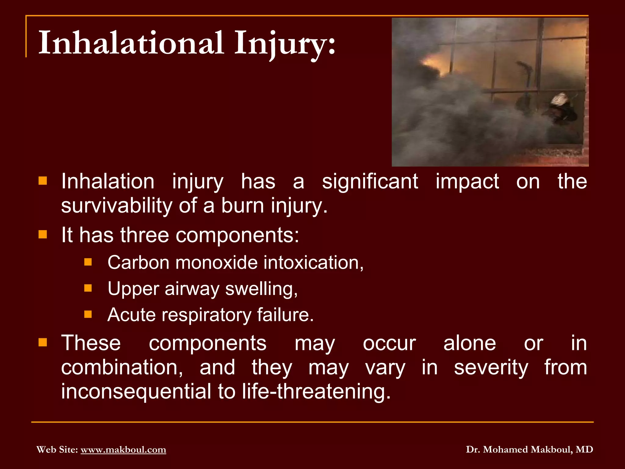 Inhalational Injury: Inhalation injury has a significant impact on the survivability of a burn injury.  It has three components:  Carbon monoxide intoxication,  Upper airway swelling,  Acute respiratory failure.  These components may occur alone or in combination, and they may vary in severity from inconsequential to life-threatening.  
