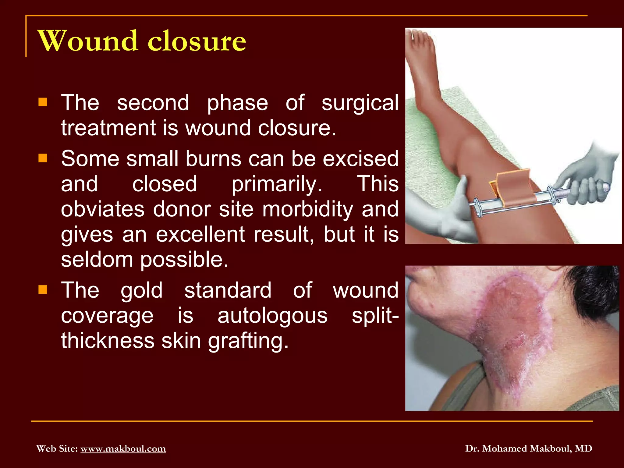 Wound closure The second phase of surgical treatment is wound closure.  Some small burns can be excised and closed primarily. This obviates donor site morbidity and gives an excellent result, but it is seldom possible.  The gold standard of wound coverage is autologous split-thickness skin grafting.  
