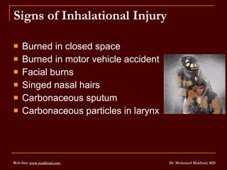 3 Burn Management | PPT