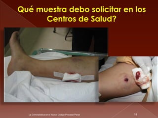Qué muestra debo solicitar en los
      Centros de Salud?




  La Criminalística en el Nuevo Código Procesal Penal   18
 