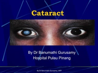 By Dr Banumathi Gurusamy, HPP
Cataract
By Dr Banumathi Gurusamy
Hospital Pulau Pinang
 