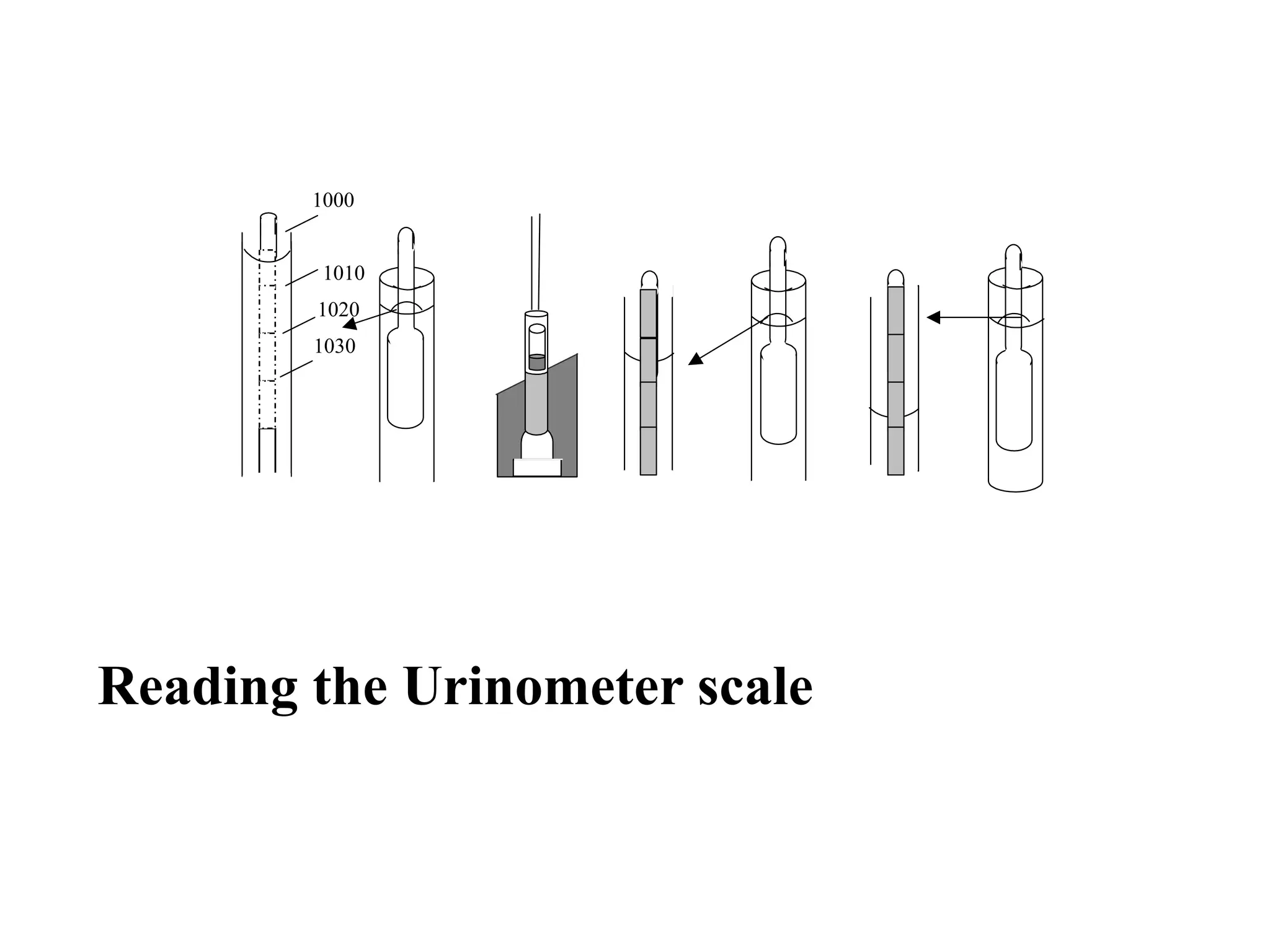 Reading the Urinometer scale
1000
1010
1020
1030
 