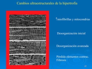 Cambios ultraestructurales de la hipertrofia  miofibrillas y mitocondrias Desorganización inicial Desorganización avanzada Pérdida elementos contrac. Fibrosis 