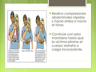  Realice  compresiones
 abdominales rápidas
 y hacia arriba o hacia
 el tórax.

 Continúe con esta
 maniobra hasta que
 la víctima elimine el
 cuerpo extraño o
 caiga inconsciente.
 