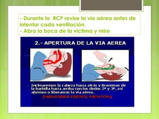 - Durante la RCP revise la vía aérea antes de
intentar cada ventilación.
- Abra la boca de la víctima y mire
 