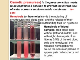 Osmotic pressure (π) is the pressure which needs
to be applied to a solution to prevent the inward flow
of water across a semipermeable membrane π=
CRT.
Hemolysis (or haemolysis)—is the rupturing of
erythrocytes (red blood cells) and the release of their
contents (hemoglobin) into surrounding fluid (in hypotonic
solution). Hemolysis of blood
samples. Red blood cells
without (left and middle) and
with (right) hemolysis. If as
little as 0.5% of the red blood
cells are hemolyzed, the
released hemoglobin will
cause the serum or plasma to
appear pale red or cherry red
in color.
 