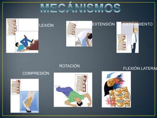 MECÁNISMOSHIPEREXTENSIÓNESTIRAMIENTOHIPERFLEXIÓNROTACIÓNFLEXIÓN LATERALCOMPRESIÓN