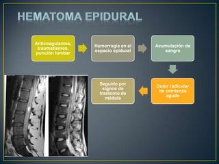 HEMATOMA EPIDURAL
