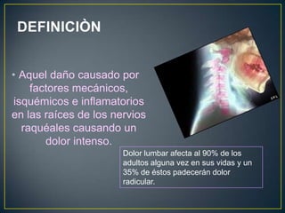 DEFINICIÒN Aquel daño causado por factores mecánicos, isquémicos e inflamatorios en las raíces de los nervios raquéales causando un dolor intenso.Dolor lumbar afecta al 90% de los adultos alguna vez en sus vidas y un 35% de éstos padecerán dolor radicular.