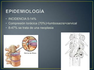 EPIDEMIOLOGÍAINCIDENCIA 5-14%Compresión torácica (70%)>lumbosacra>cervical8-47% se trata de una neoplasia