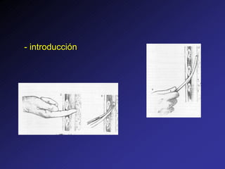 - introducción
 