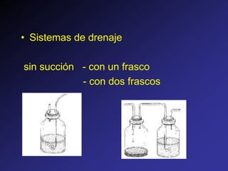 • Sistemas de drenaje
sin succión - con un frasco
- con dos frascos
 