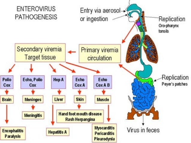 cadena epidemiologica poliomelitis coxsackie virus cadena epidemiologica poliomelitis coxsackie virus