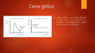 Cierre glótico
 Cierre glótico con caída abrupta
a flujo cero en la curva FV y
meseta completamente plana
(sin cambio en volumen).
 
