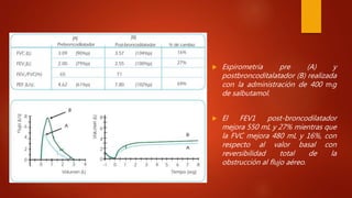  Espirometría pre (A) y
postbroncoditalatador (B) realizada
con la administración de 400 mg
de salbutamol.
 El FEV1 post-broncodilatador
mejora 550 mL y 27% mientras que
la FVC mejora 480 mL y 16%, con
respecto al valor basal con
reversibilidad total de la
obstrucción al flujo aéreo.
 