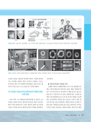 프린팅 기술을 이용하여 제작해 주었다. 이렇게 제작된
기도 지지체는 원하는 대로 이식될 수 있었고, 기도는
유지되어 점막 조직 재생에 성공하였고, 네르구이는 태
어나서 처음 코로 스스로 숨을 쉴 수 있게 되었다.
3D 프린팅 기술의 바이오분야로의 적용에 관한
미래 전망
위의 국내・외 사례들을 통해 확인할 수 있듯이, 3D
프린팅 기술의 바이오 메디컬 분야로의 적용 가능성은
매우 무궁무진하다 할 수 있다. 따라서, 향후 3D 프린팅
기술이 가져올 바이오 메디컬 분야의 미래를 전망해 보
고자 한다.
▶ 세포/조직/장기 프린팅 시대
고령화 사회가 도래함에 따라, 장기 수급 불균형의 문
제는 사회 문제로까지 대두되고 있다. 해를 거듭할수록
장기 이식 대기자수는 증가하는 추세를 보이고 있으며,
반면 장기 기증자의 수는 답보 상태에 있다. 이러한 문
제의 근본 해결책으로서 조직 및 장기의 재생을 가능케
하는 조직공학이 각광을 받고 있으며, 더욱이 세포 및
조직/장기를 직접 프린팅하는 개념인 바이오 프린팅 기
술은 많은 사람들의 관심을 끌고 있는 분야이다. 바이오
프린팅 기술은 살아있는 세포를 원하는 형상 또는 패턴
2014. 4., Vol. 54, No. 4 ● 55
그림 6 환자 수술 전후 사진(왼쪽), 기도 지지체 제작 과정(가운데), 수술 성공 후 환자와 연구진이 함께 찍은 사진(오른쪽)
그림 7 바이오 프린팅 개념도(왼쪽) 및 실험을 통해 보여진 프린팅된 세포의 조직으로의 생성 가능성(오른쪽)
3저널(4월호).ok 2014.3.31 9:48 AM 페이지55 DK
 