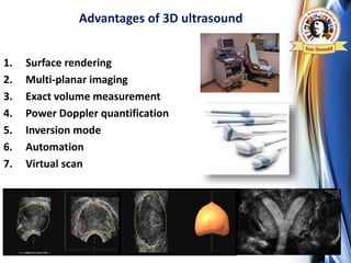 3d 4d Ultrasound In Uterine Septum Evaluation