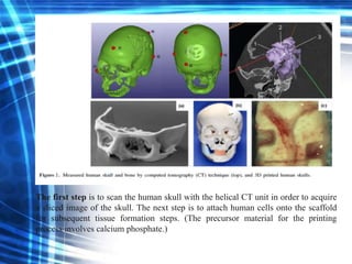 The first step is to scan the human skull with the helical CT unit in order to acquire
a sliced image of the skull. The next step is to attach human cells onto the scaffold
for subsequent tissue formation steps. (The precursor material for the printing
process involves calcium phosphate.)
 