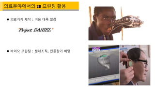  바이오 프린팅 : 생체조직, 인공장기 배양
 의료기기 제작 : 비용 대폭 절감
의료분야에서의 3D 프린팅 활용
“Project DANIEL”
 