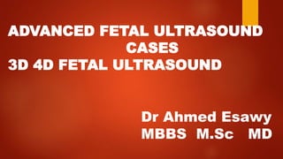 Dr Ahmed Esawy
MBBS M.Sc MD
ADVANCED FETAL ULTRASOUND
CASES
3D 4D FETAL ULTRASOUND
 