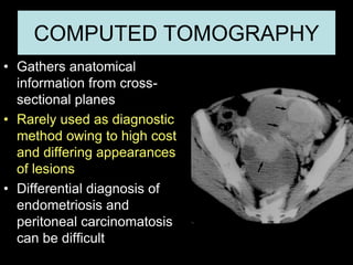 COMPUTED TOMOGRAPHY
• Gathers anatomical
information from cross-
sectional planes
• Rarely used as diagnostic
method owing...