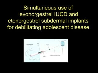 Simultaneous use of
levonorgestrel IUCD and
etonorgestrel subdermal implants
for debilitating adolescent disease
 