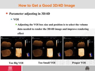 Parameter adjusting in 3D/4D
VOI
Adjusting the VOI box size and position is to select the volume
data needed to render the 3D/4D image and improve rendering
effect
How to Get a Good 3D/4D Image
Too Big VOI Too Small VOI Proper VOI
 