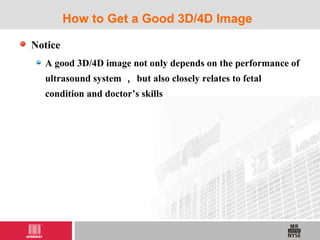 Notice
A good 3D/4D image not only depends on the performance of
ultrasound system ， but also closely relates to fetal
condition and doctor’s skills
How to Get a Good 3D/4D Image
 