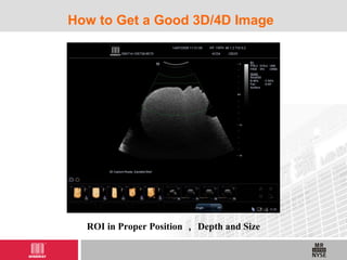 How to Get a Good 3D/4D Image
ROI in Proper Position ， Depth and Size
 