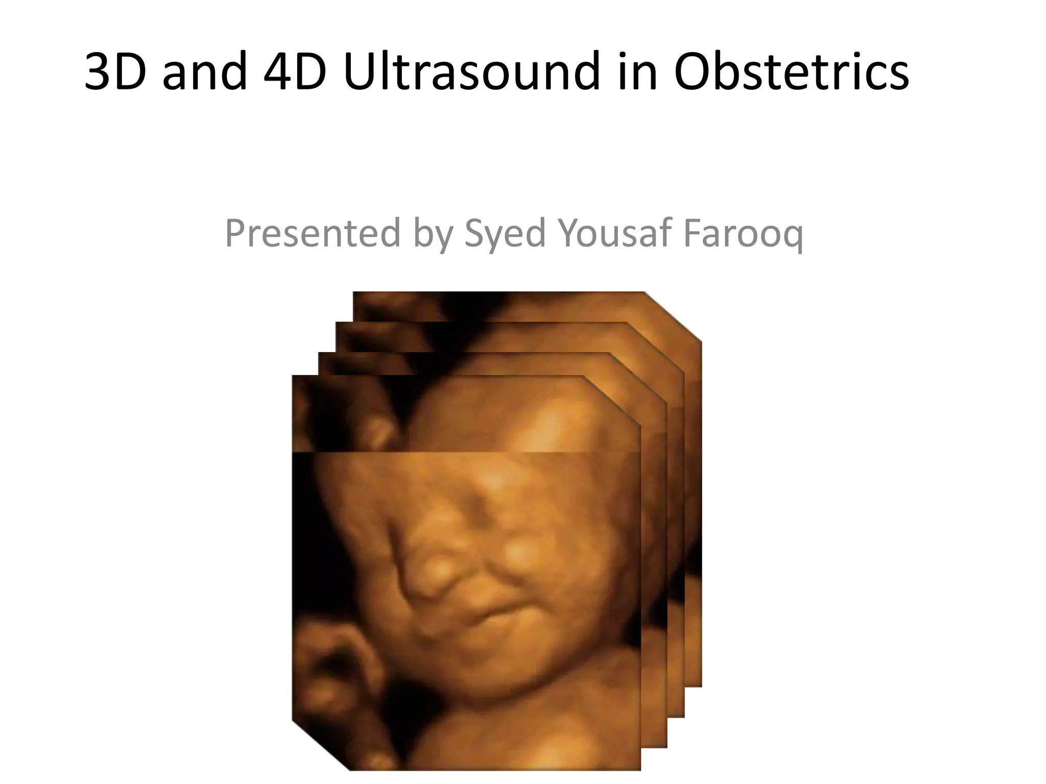 3D and 4D ultrasound in obstetrics | PPTX