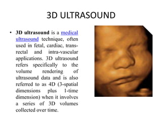3D and 4D ultrasound in obstetrics | PPTX
