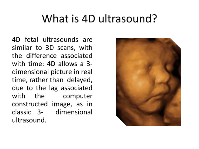 3D and 4D ultrasound in obstetrics | PPTX