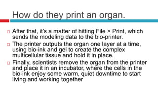 How do they print an organ. 
 After that, it's a matter of hitting File > Print, which 
sends the modeling data to the bio-printer. 
 The printer outputs the organ one layer at a time, 
using bio-ink and gel to create the complex 
multicellular tissue and hold it in place. 
 Finally, scientists remove the organ from the printer 
and place it in an incubator, where the cells in the 
bio-ink enjoy some warm, quiet downtime to start 
living and working together 
 