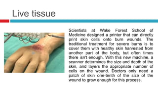 Live tissue
Scientists at Wake Forest School of
Medicine designed a printer that can directly
print skin cells onto burn wounds. The
traditional treatment for severe burns is to
cover them with healthy skin harvested from
another part of the body, but often times
there isn't enough. With this new machine, a
scanner determines the size and depth of the
skin, and layers the appropriate number of
cells on the wound. Doctors only need a
patch of skin one-tenth of the size of the
wound to grow enough for this process.
 