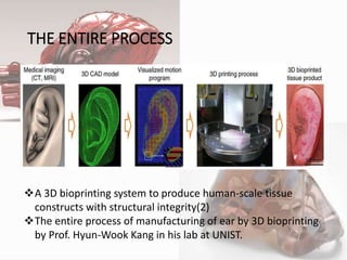 THE ENTIRE PROCESS
A 3D bioprinting system to produce human-scale tissue
constructs with structural integrity(2)
The entire process of manufacturing of ear by 3D bioprinting
by Prof. Hyun-Wook Kang in his lab at UNIST.
9
 