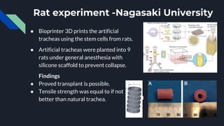 Rat experiment -Nagasaki University
● Bioprinter 3D prints the artificial
tracheas using the stem cells from rats.
● Artificial tracheas were planted into 9
rats under general anesthesia with
silicone scaffold to prevent collapse.
Findings
● Proved transplant is possible.
● Tensile strength was equal to if not
better than natural trachea.
 