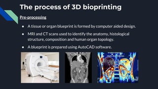 The process of 3D bioprinting
Pre-processing
● A tissue or organ blueprint is formed by computer aided design.
● MRI and CT scans used to identify the anatomy, histological
structure, composition and human organ topology.
● A blueprint is prepared using AutoCAD software.
 