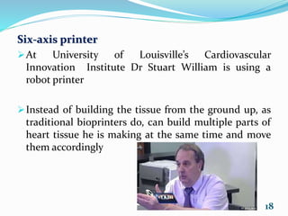 Six-axis printer
At University of Louisville’s Cardiovascular
Innovation Institute Dr Stuart William is using a
robot printer
Instead of building the tissue from the ground up, as
traditional bioprinters do, can build multiple parts of
heart tissue he is making at the same time and move
them accordingly
18Dr StuartWilliam
 