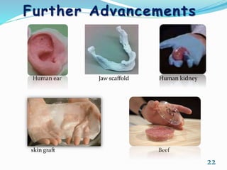Further Advancements
Human ear Jaw scaffold Human kidney
Human Kidney
skin graft Beef
22
 